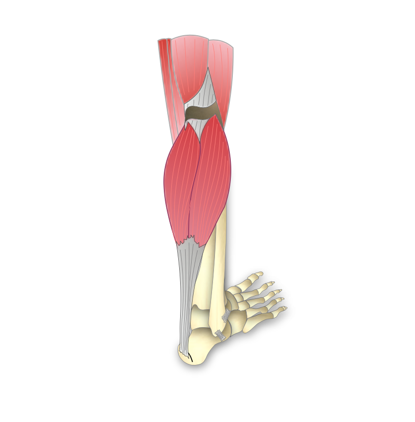 Rétraction des muscles du mollet - Dr Bovier-Lapierre